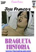Bragueta Historia